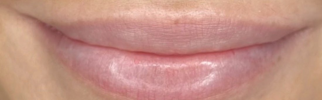 Before her Lip Blush