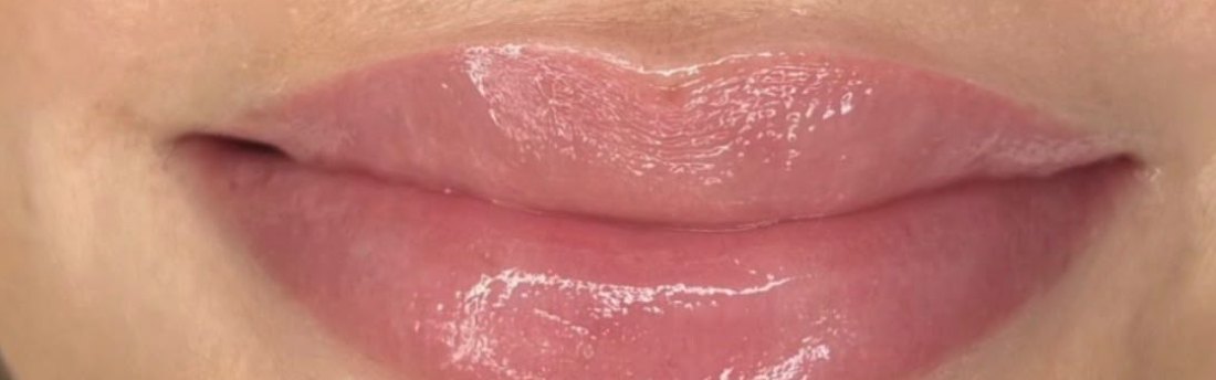 Her Lip Blush, healed