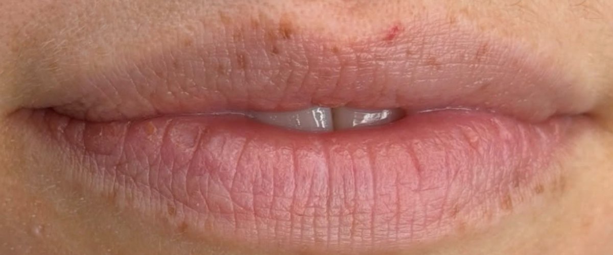 Real client before her Lip Blush